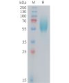 sp-PME101408 FGFR2IIIb Fig.1 SDS PAGE 1