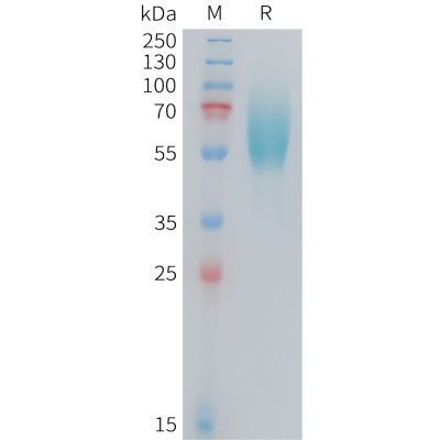 sp-PME101408 FGFR2IIIb Fig.1 SDS PAGE 1