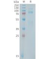 sp-PME101409 MET Fig.1 SDS PAGE 1