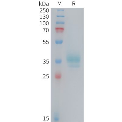 sp-PME101410 OR2H1 Fig.1 SDS PAGE 1