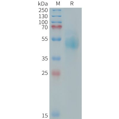 sp-PME101412 HER3 Fig.1 SDS PAGE 1