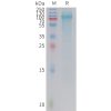 sp-PME101413 ADGRD1 Fig.1 SDS PAGE 1