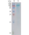 sp-PME101413 ADGRD1 Fig.1 SDS PAGE 1