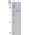 sp-PME101414 GAL Fig.1 SDS PAGE 1