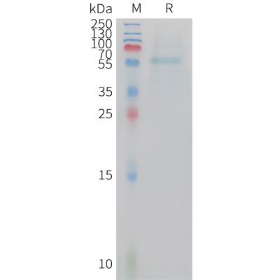 sp-PME101416 ADIPOQ Fig.1 SDS PAGE 1