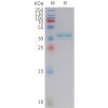 sp-PME101417 LEP Fig.1 SDS PAGE 1