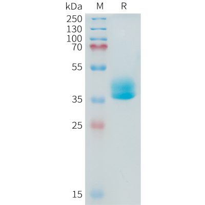 sp-PME101418 ADAM17 Fig.1 SDS PAGE 1