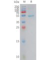 sp-PME101419 CRCP Fig.1 SDS PAGE 1