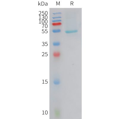 sp-PME101419 CRCP Fig.1 SDS PAGE 1