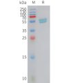 sp-PME101420 IFNA2 Fig.1 SDS PAGE 1