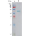 sp-PME101421 CCL5 Fig.1 SDS PAGE 1