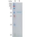 sp-PME101422 CCL3 Fig.1 SDS PAGE 1