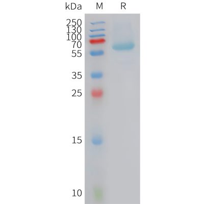 sp-PME101423 BAMBI Fig.1 SDS PAGE 1