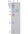 sp-PME101424 XCR1 Fig.1 SDS PAGE 1