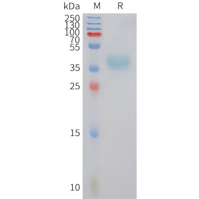 sp-PME101424 XCR1 Fig.1 SDS PAGE 1