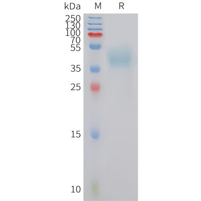 sp-PME101425 MC4R Fig.1 SDS PAGE 1