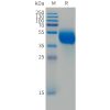 sp-PME101493 FCRL5 Fig.1 SDS PAGE 1