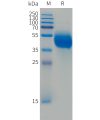 sp-PME101493 FCRL5 Fig.1 SDS PAGE 1