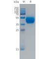 sp-PME101494 FCRL5 Fig.1 SDS PAGE 1