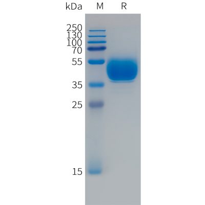 sp-PME101494 FCRL5 Fig.1 SDS PAGE 1