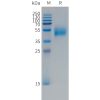sp-PME101495 FCRL5 Fig.1 SDS PAGE 1