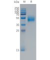 sp-PME101495 FCRL5 Fig.1 SDS PAGE 1