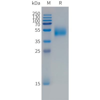 sp-PME101495 FCRL5 Fig.1 SDS PAGE 1