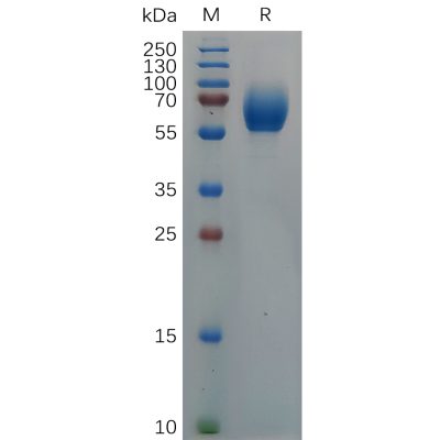 sp-pme c100001 il18bp sp1