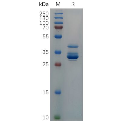 sp-pme c100002 cxcl10 sp1