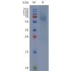 sp-pme c100005 ighe sp1