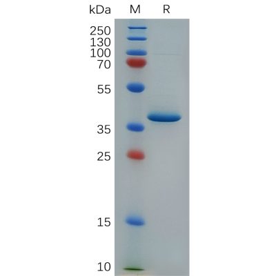 sp-pme c100007 cxcl4 sp1