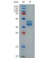 sp-pme c100008 anxa2 sp1