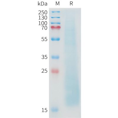 sp-pme c100026 muc1 sp1