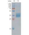 sp-pme c100039 mesothelin sp1