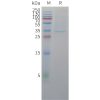 sp-pme c100050 cldn18.2 sp1