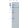 sp-pme c100055 cd79b sp1