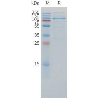 sp-pme c100056 lag3 sp1