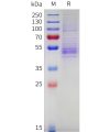 sp-pme c100086 nkg2a sp1