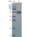 sp-pme d100001 il18bp sp1