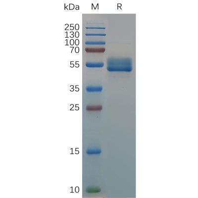 sp-pme d100001 il18bp sp1