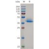 sp-pme d100002 anxa2 sp1