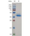 sp-pme d100002 anxa2 sp1