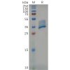 sp-pme m100001 bcma sp1