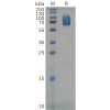 sp-pme m100004 2b4 sp1