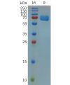 sp-pme m100013 trop2 sp1