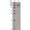 sp-pme m100014 cd138 sp1