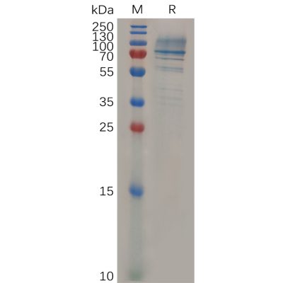 sp-pme m100014 cd138 sp1