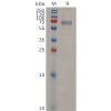 sp-pme m100015 cd33 sp1