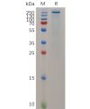 sp-pme m100021 tenm4 sp1