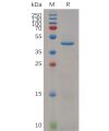 sp-pme m100023 rnase4 sp1